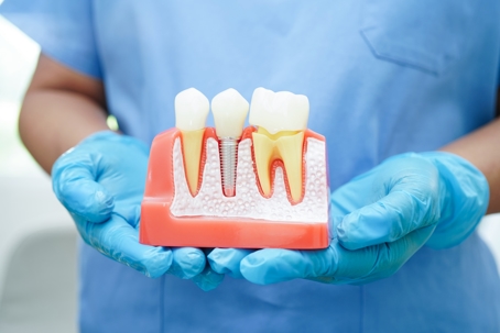 All-on-4®: Full-Arch Teeth Replacement in Oak Lawn & Orland Park