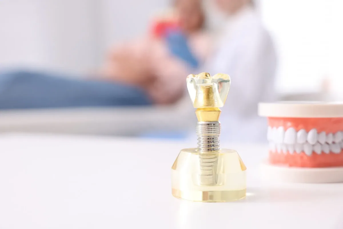Model of a dental implant and crown resting on a table